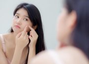 Cara Memilih Produk Skincare untuk Kulit Berjerawat