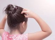 Tips Menjaga Kesehatan Kulit Kepala Setelah Lebaran Mengatasi Rambut Rontok dan Ketombe Akibat Perubahan Pola Makan